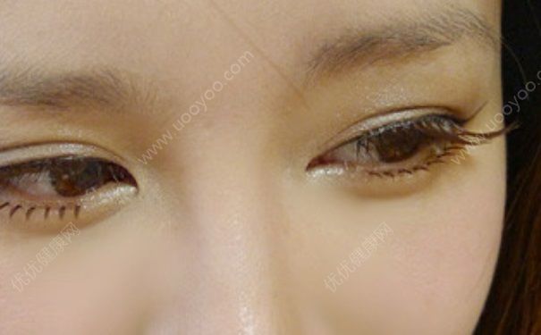 假睫毛对眼睛有害吗？假睫毛可以重复使用吗？(2)