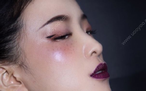 脸上长雀斑怎么去掉？脸上长雀斑怎么办？(6)