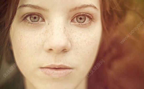 女生长雀斑是什么原因？女生长雀斑怎么调理？(3)