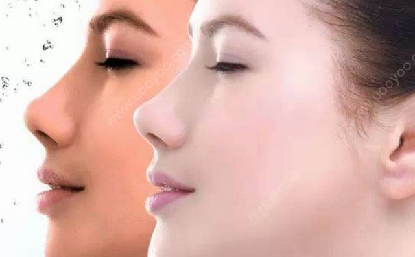 白醋可以祛斑吗？白醋可以美白吗？(1)