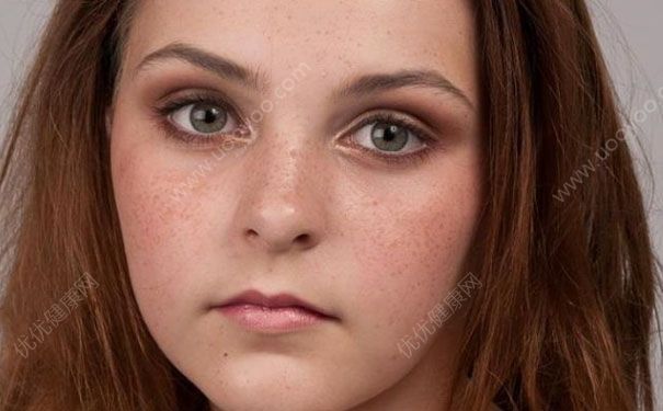 有雀斑能喝咖啡吗？喝咖啡会长斑吗？[多图]