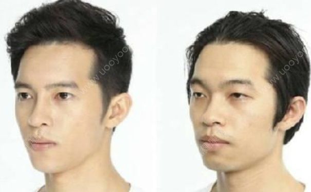 韩女星鼻子塌陷 整容后遗症有哪些？(2)