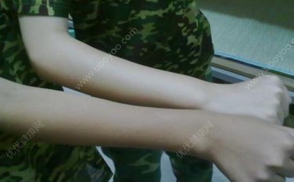 军训如何防晒黑？军训如何防晒？(1)