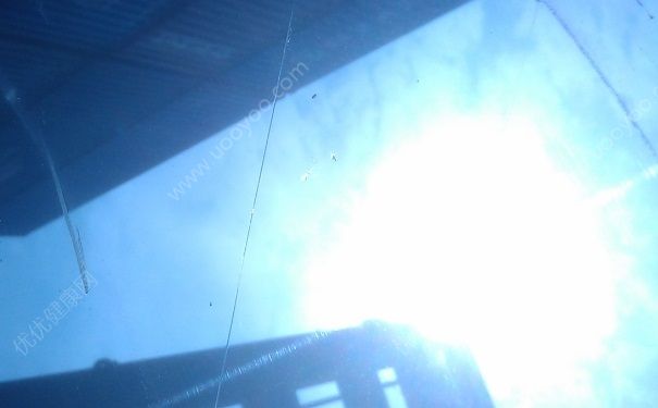 阳光对眼睛的伤害大吗？紫外线损伤眼睛怎么办？(2)