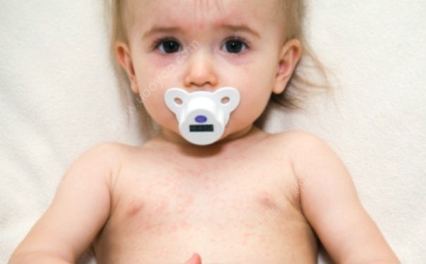 小孩怎么预防手足口病？小孩预防针可以推迟打吗？(4)