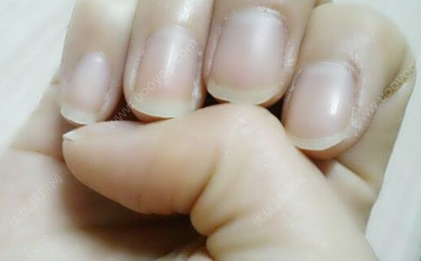 手指上的月牙白代表什么？手指上的月牙代表什么？[多图]