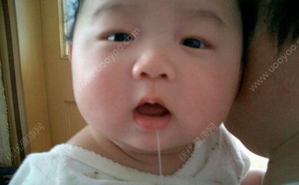 宝宝流口水是什么原因？宝宝流口水厉害怎么办？(3)