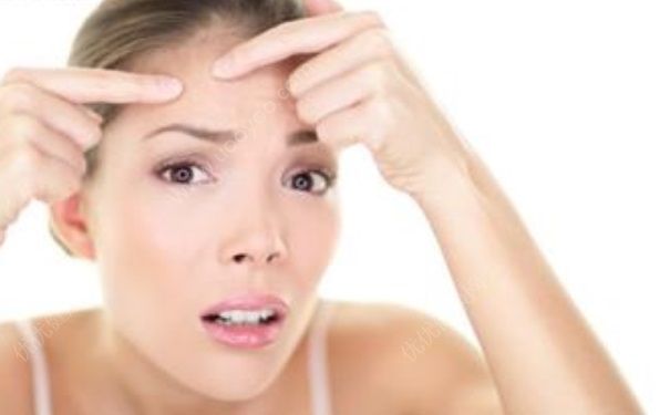 痘痘能不能挤掉？脸上长痘痘能不能挤？[多图]