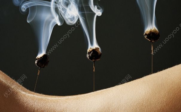 腰肌劳损针灸有用吗？腰肌劳损针灸治疗方法[图]
