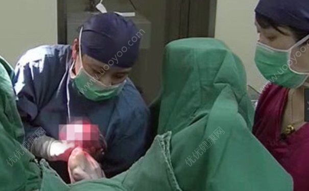 顺产剖腹产哪个痛？顺产剖腹产哪个风险大？(4)
