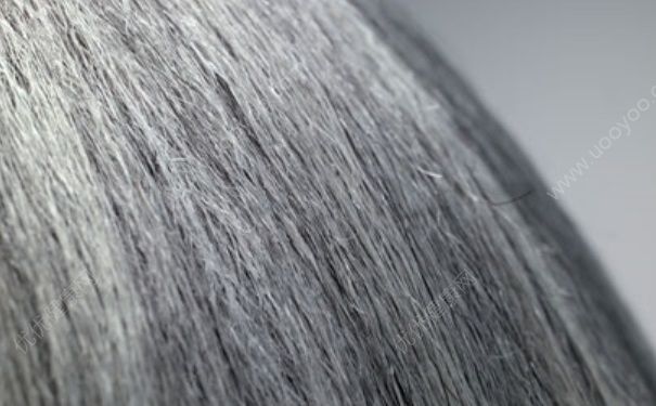 少白头是什么原因？少白头发怎么治疗？[图]