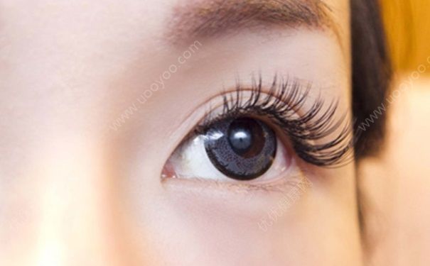 睫毛倒插怎么办？眼睛下睫毛倒插怎么办？[图]