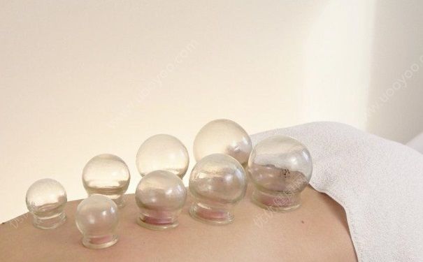 肩周炎拔罐在哪个部位？肩周炎拔火罐的位置[图]