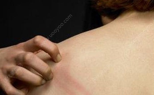 皮肤瘙痒是病吗？皮肤瘙痒怎么治疗？[图]