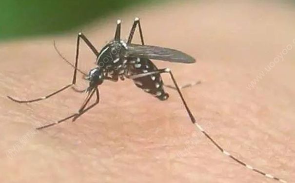 防蚊的工具有哪些？被蚊子咬了怎么止痒？[图]