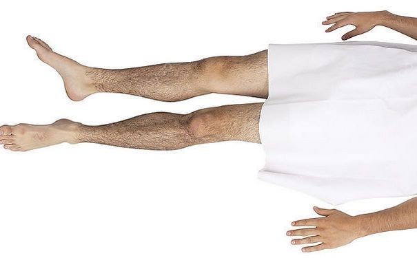 男性腿毛多说明了什么？男性腿毛多是什么原因？(1)