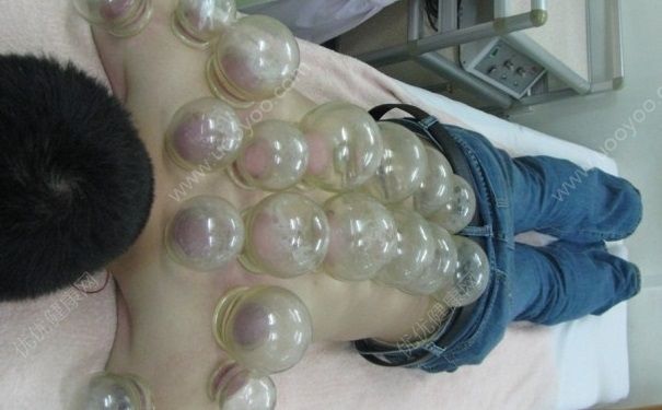 拔罐后能喝酒吗？拔罐后喝酒可以吗？(1)