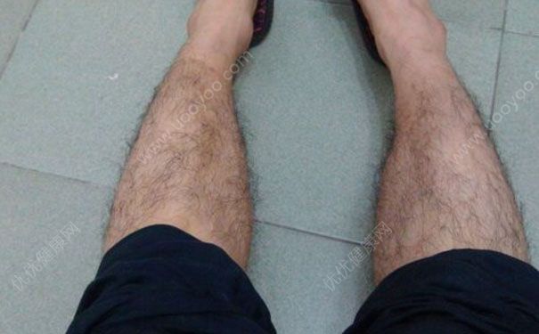 男人腿毛多说明什么？男人腿毛多怎么办？(1)