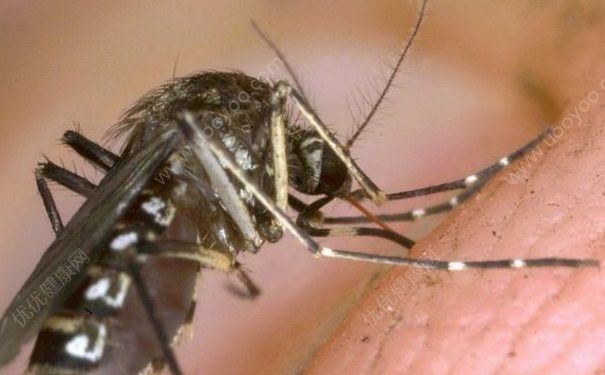 有蚊子可是没蚊香怎么办？没有蚊香怎么驱蚊？[图]