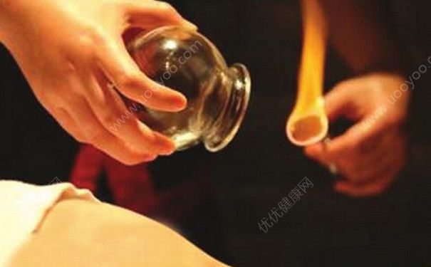 拔罐减肥会影响月经吗？拔罐会影响月经推迟吗？(1)