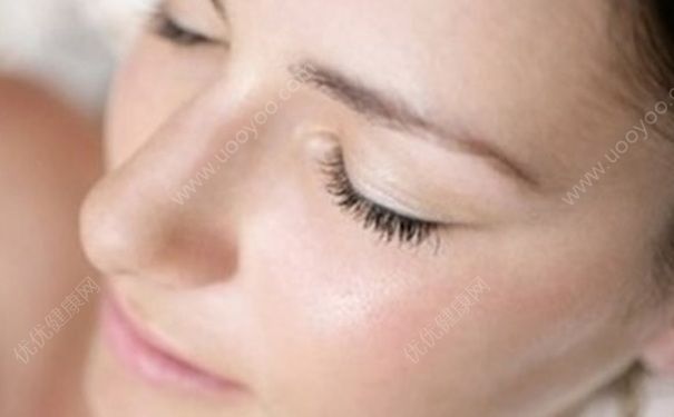 鼻子上有黑头怎么清除？有哪些去黑头的方法？(1)