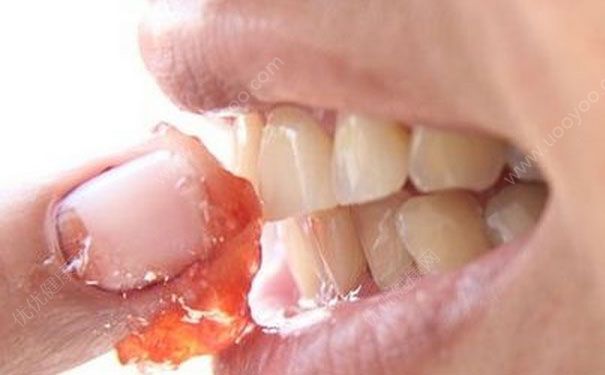 怎么用草莓美白牙齿？草莓美白牙齿的方法(1)