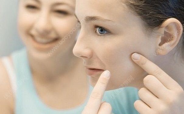 月经期间长痘痘怎么办？月经期间长痘怎样预防？(1)