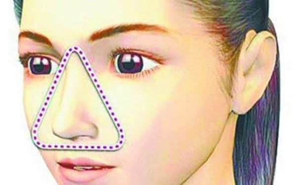 三角区的痘痘挤了怎么办？挤了三角区痘痘怎么处理(1)