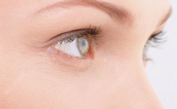 去鱼尾纹的最好方法 用什么去鱼尾纹最好？(1)