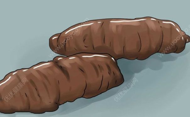 大便的颜色代表什么？大便的颜色和健康有什么关系(1)