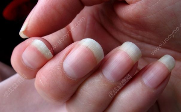 指甲长得快是什么原因？指甲长的快是怎么回事？[图]