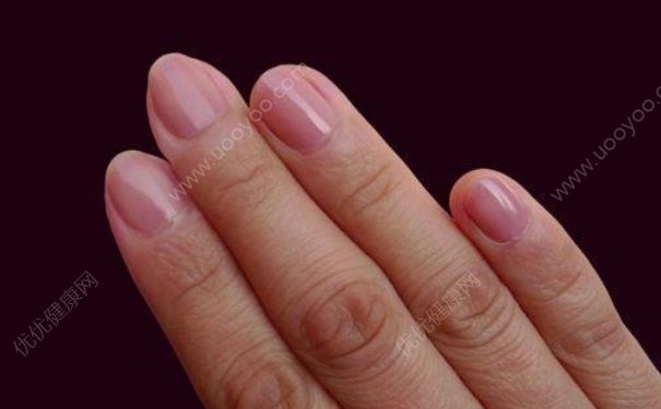 指甲有小坑怎么办？指甲凹凸不平怎么办？[图]