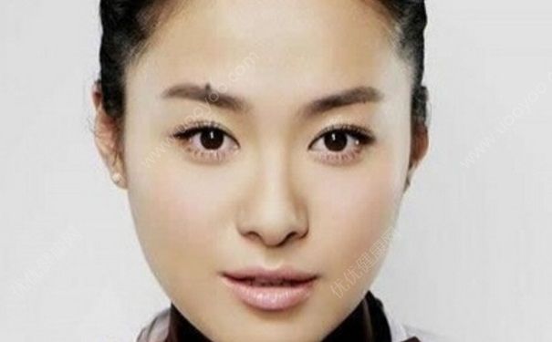 为什么脸上会长痣？什么原因让脸上长痣？(3)