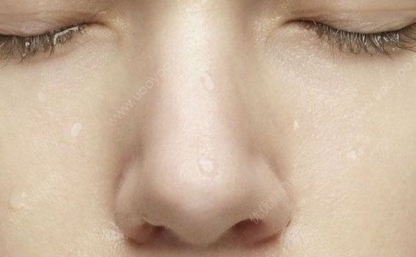 角质层厚的表现有哪些？角质层厚有什么症状？(1)