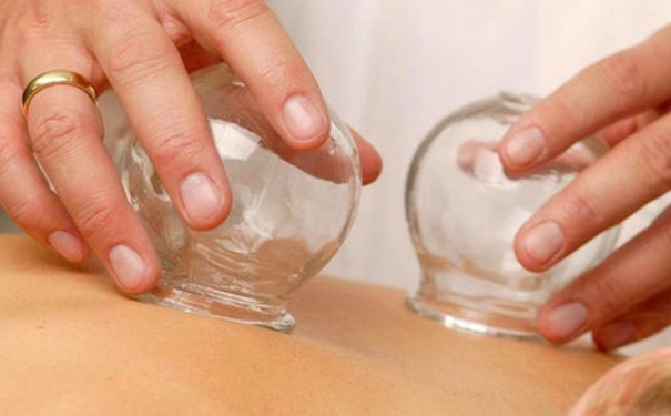 减肥拔火罐减肥拔哪里？拔罐减肥有效吗？[图]