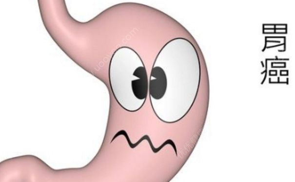胃癌能治愈吗？胃癌的早期症状[图]