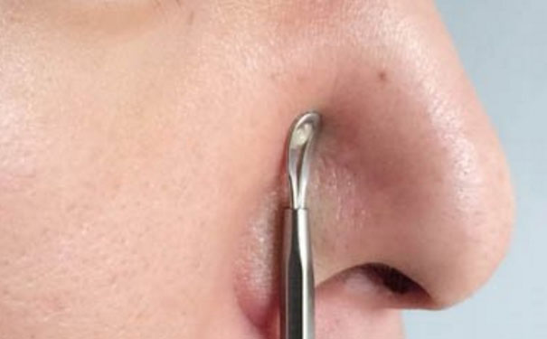 用粉刺针挑痘痘会不会留疤？用粉刺针划痘痘变黑怎么办？(1)