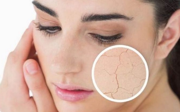 干性皮肤有什么特征？干性肌肤的特点(1)