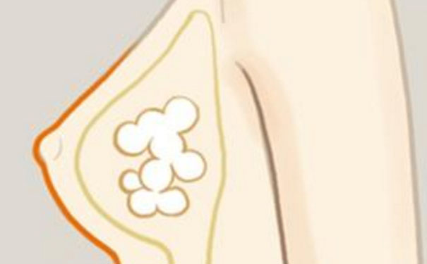 女人乳房怎么保养？女人怎么保养乳房？[图]