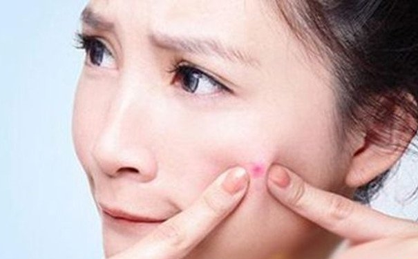 什么护肤品祛痘最好？祛痘最好的护肤品？(1)