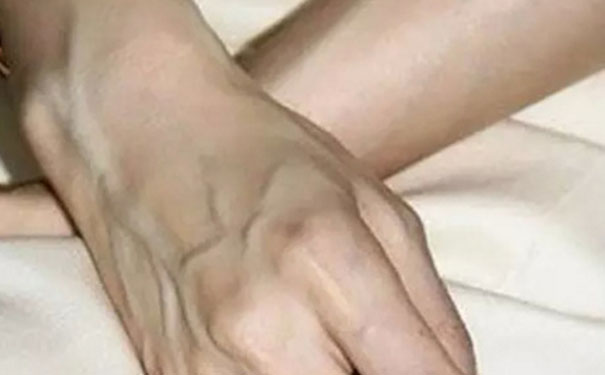 手臂青筋明显是怎么回事？手臂青筋暴起是什么原因？(1)