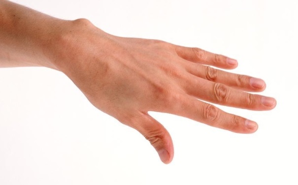 经常手麻是怎么回事？经常手麻是什么原因引起的？(1)