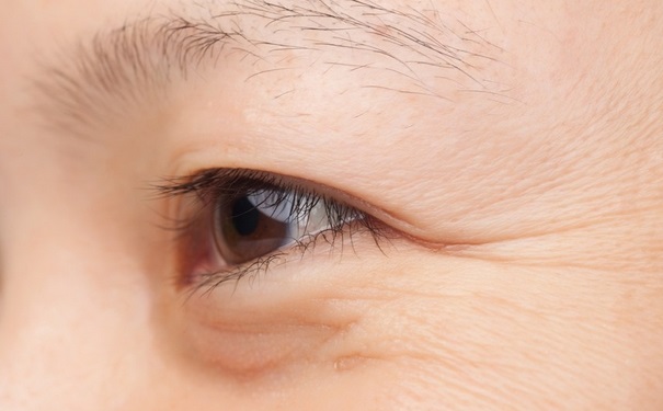 预防皱纹要吃什么？怎样预防皱纹？(1)