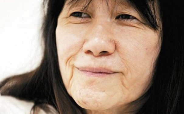 皮肤松弛是什么原因？皮肤松弛是怎么回事？(1)