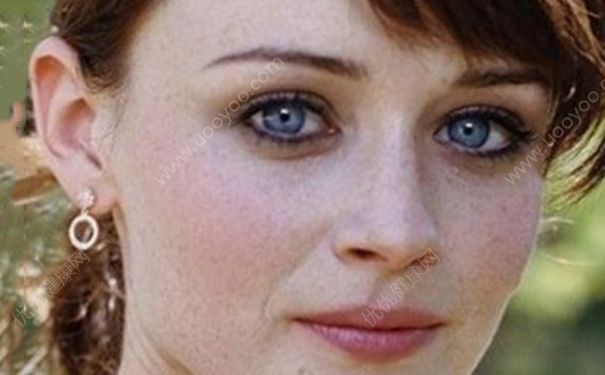 月经不调脸上会长斑吗？月经不调脸上长斑怎么办？(1)