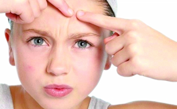 如何预防痘痘复发？如何预防痤疮反复发作？(1)