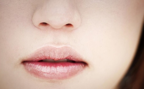 孕妇嘴唇干裂怎么办？ 孕妇嘴唇干裂脱皮怎么办？(1)