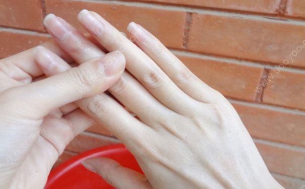 如何预防冻手？怎么提前预防冻手？(5)