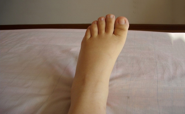 孕妇手脚肿是什么原因？孕妇手脚肿是怎么回事？(1)