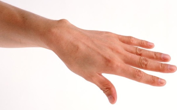 指甲上的月牙痕代表什么？手指甲上的月牙与健康的关系？(1)